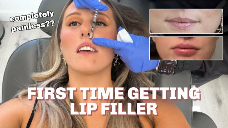 how much is half a syringe of lip filler mA703lt7jQc