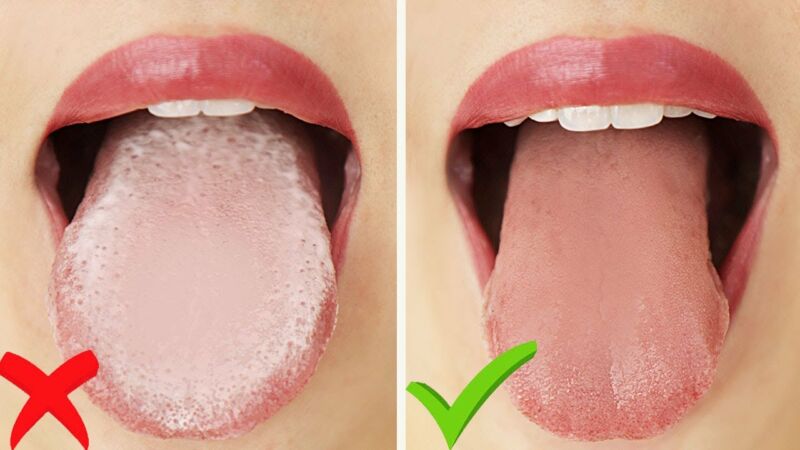how to get a pink tongue 7gO7FBAGZ1o