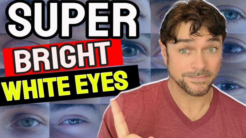 how to make your eyes whiter ImAf mU5cvk
